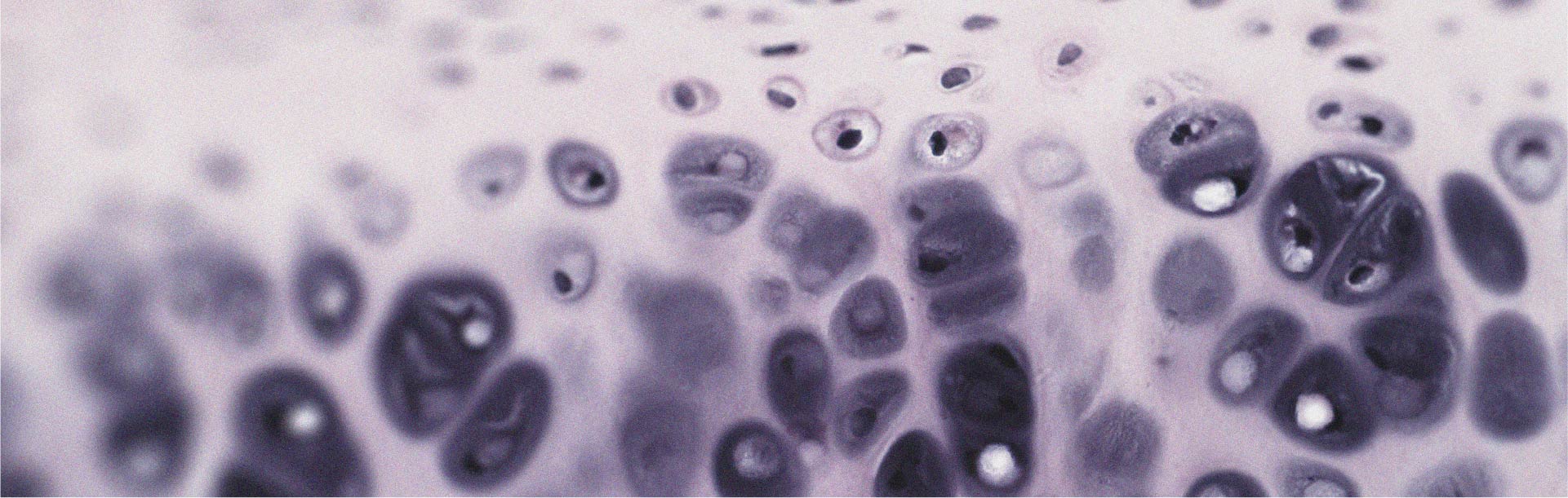 Comment le collagène peut aider à soulager l’arthrose du genou