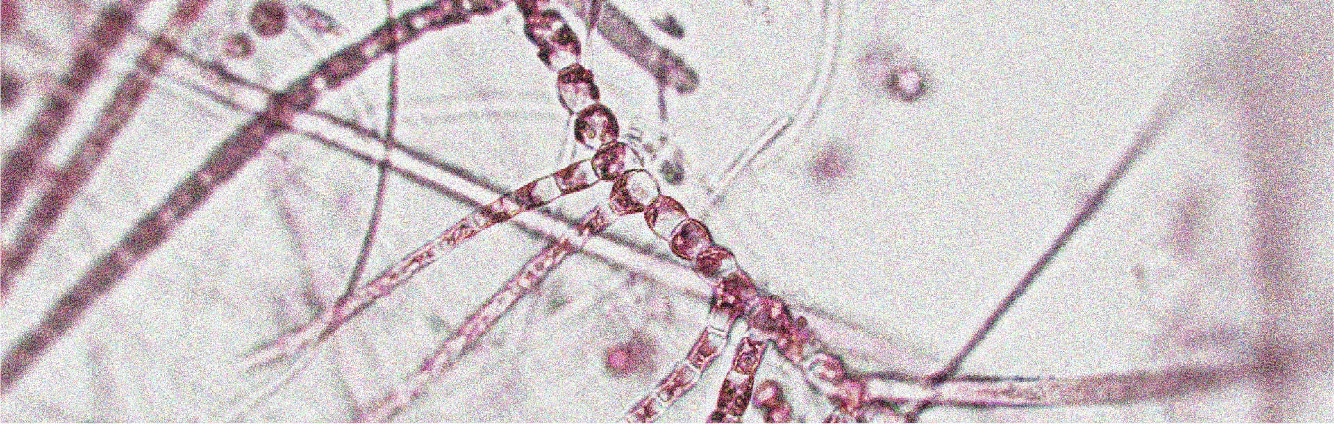 Un microbiote sain et varié pourrait favoriser la longévité